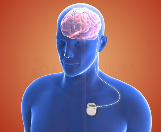 brain damage shot